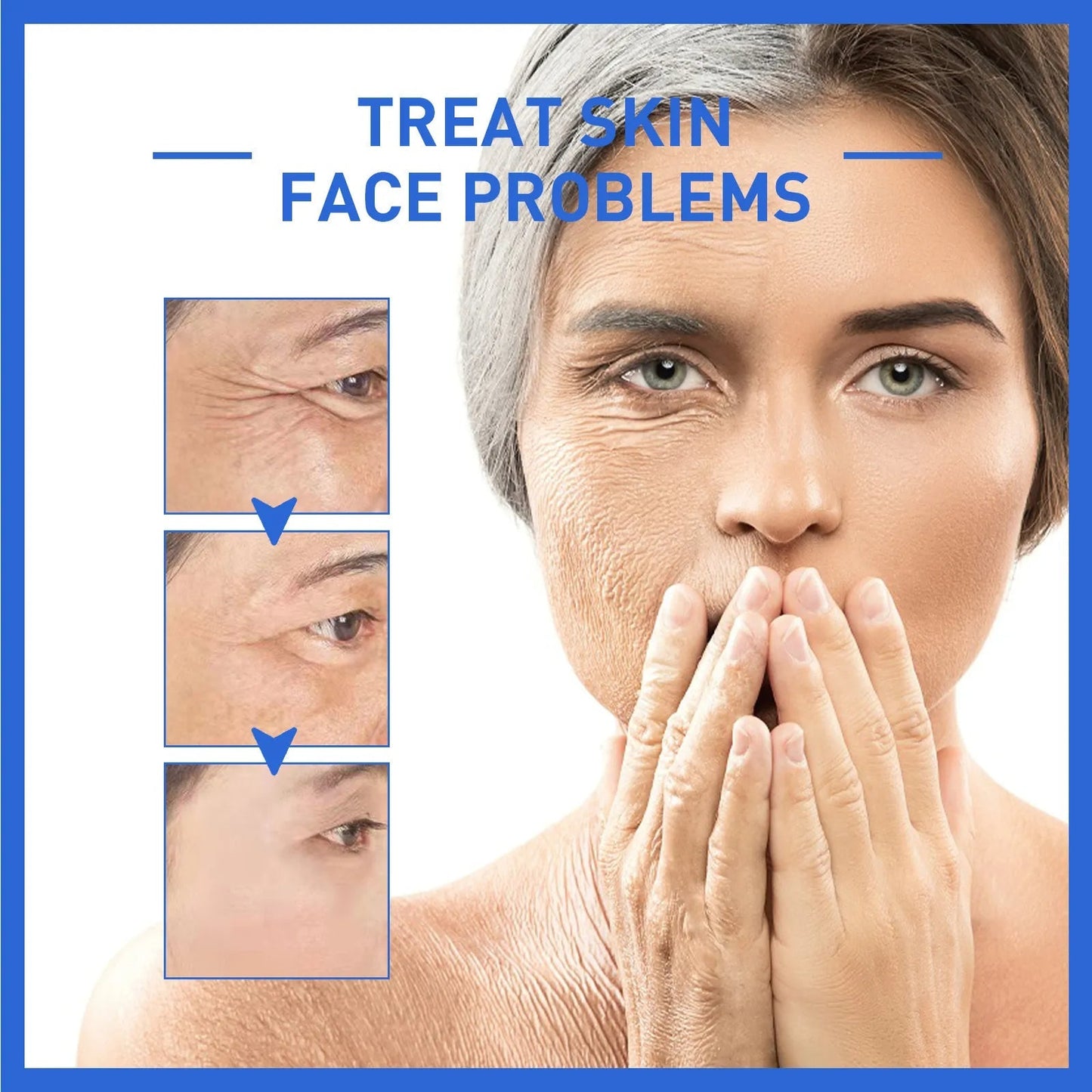 Anti aging WEST& MONTH