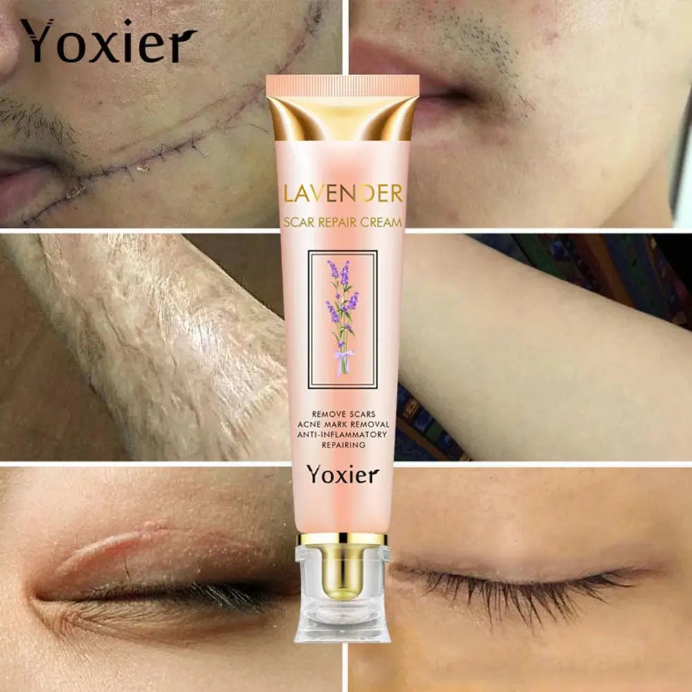 Healing Cream YOXIER