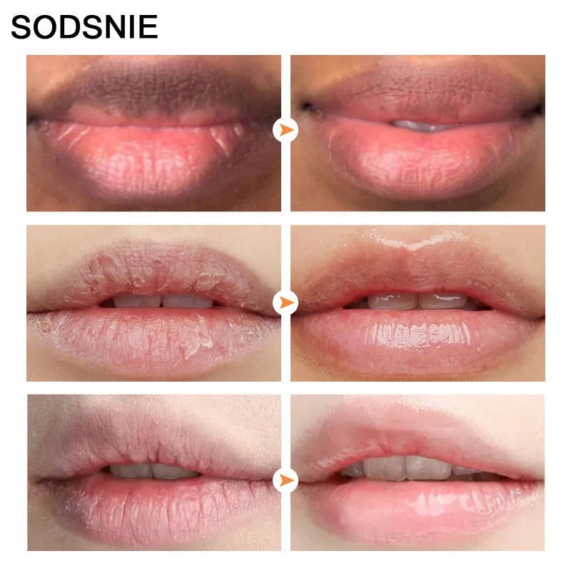 Lip Lightening SODSINE