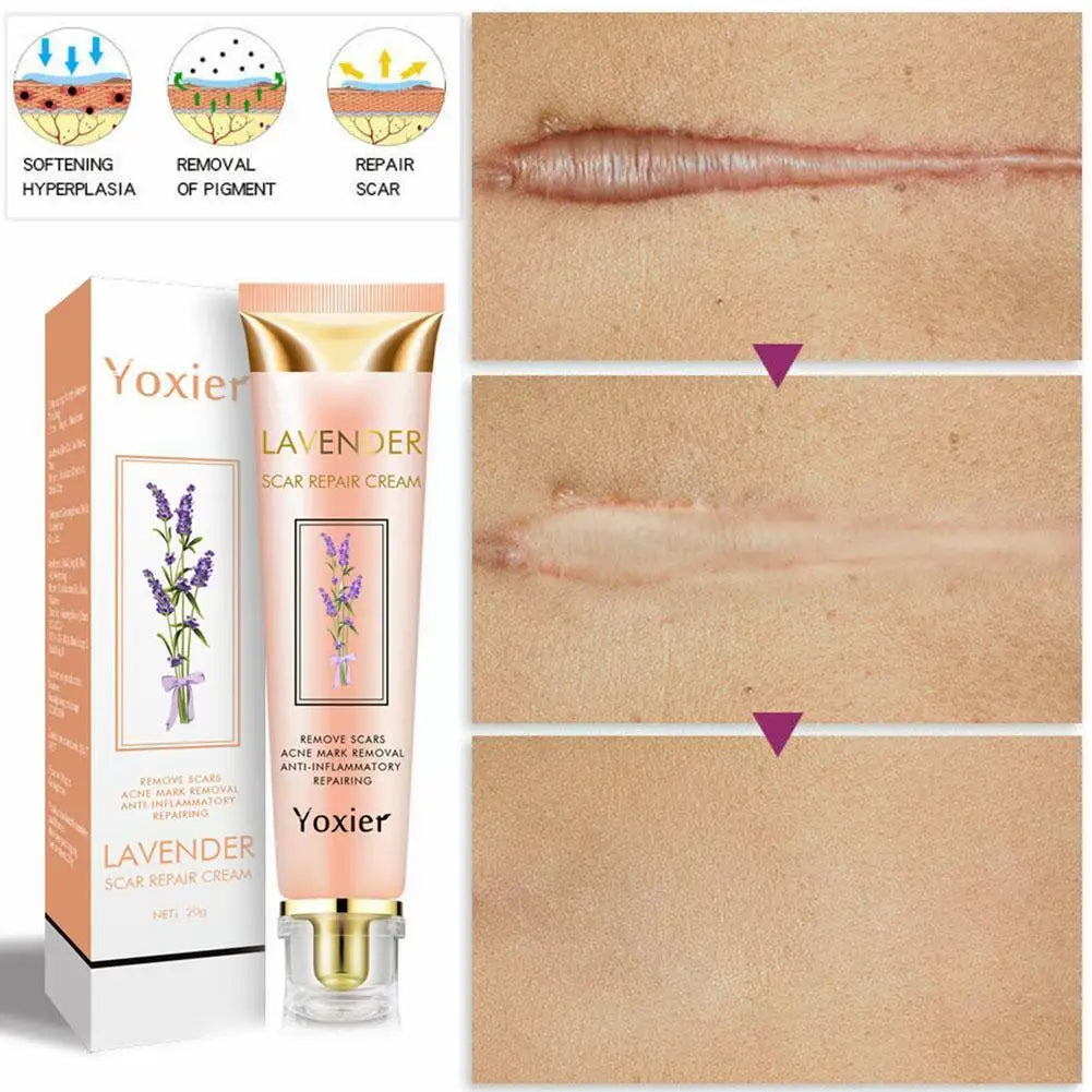 Healing Cream YOXIER