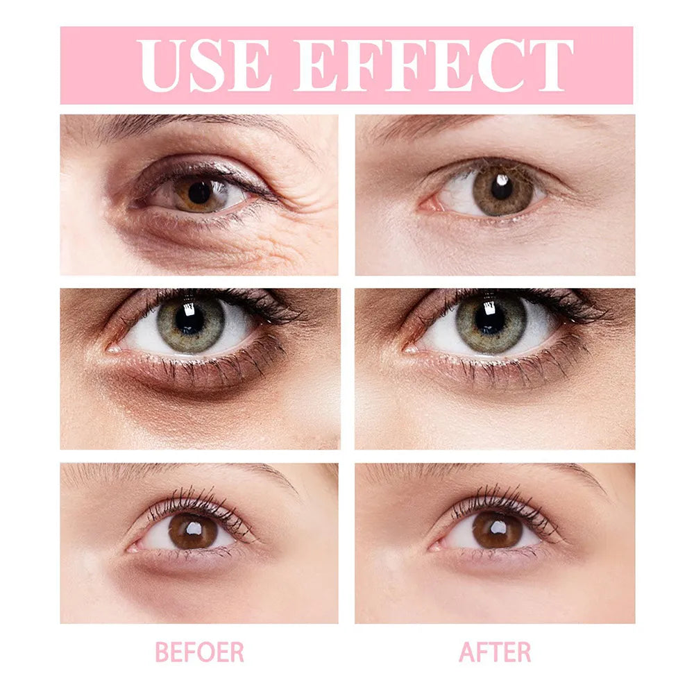 Anti wrinkle Contour EELHOE