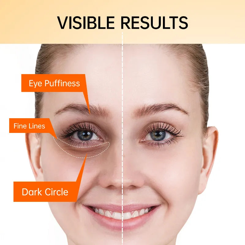 Eye Cream JOYPRETRY