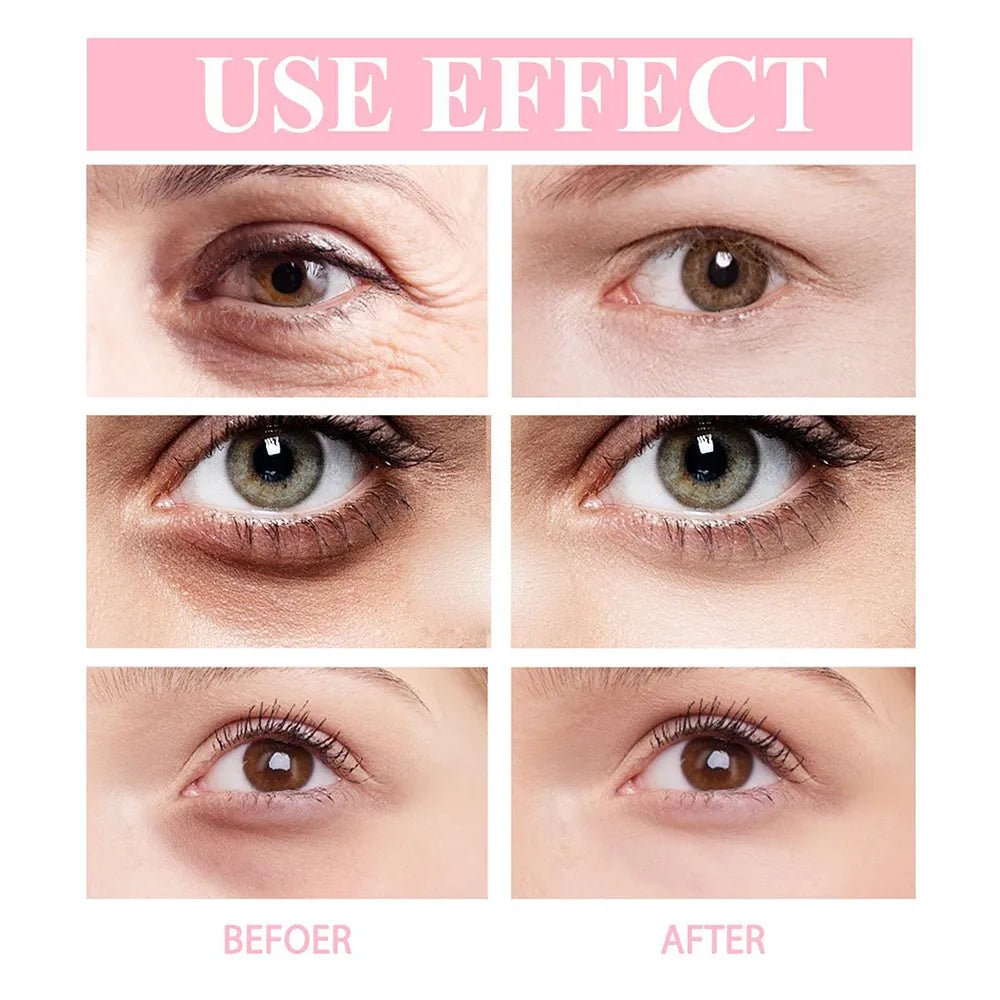 Anti wrinkle Contour EELHOE - myglowmuse