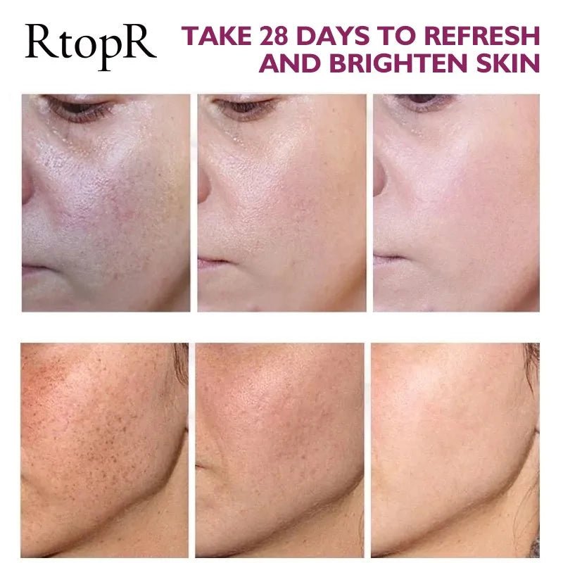 Anti Wrinkle Cream RTOPR - myglowmuse