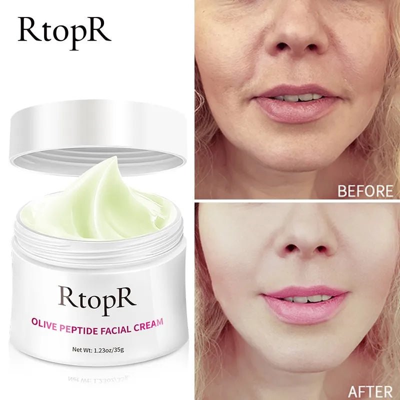 Anti Wrinkle Cream RTOPR - myglowmuse