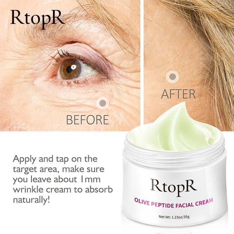 Anti Wrinkle Cream RTOPR - myglowmuse