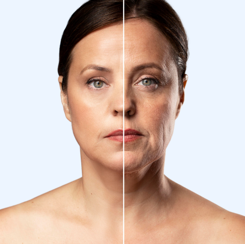Anti aging WEST& MONTH