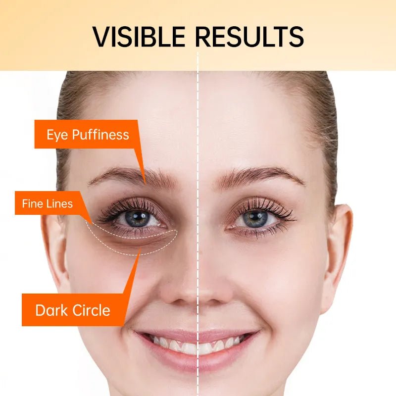 Eye Cream JOYPRETRY - myglowmuse