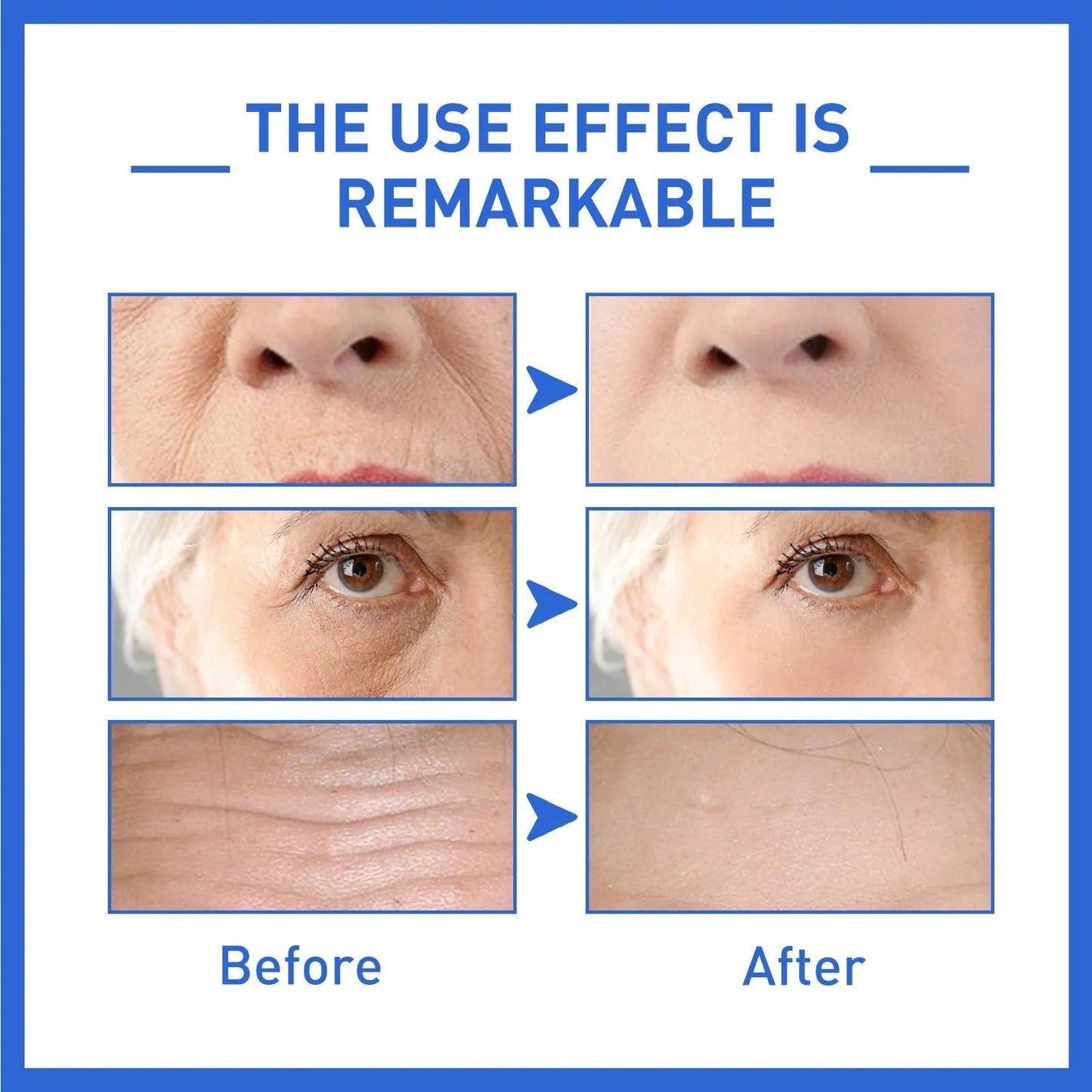 Anti aging WEST& MONTH