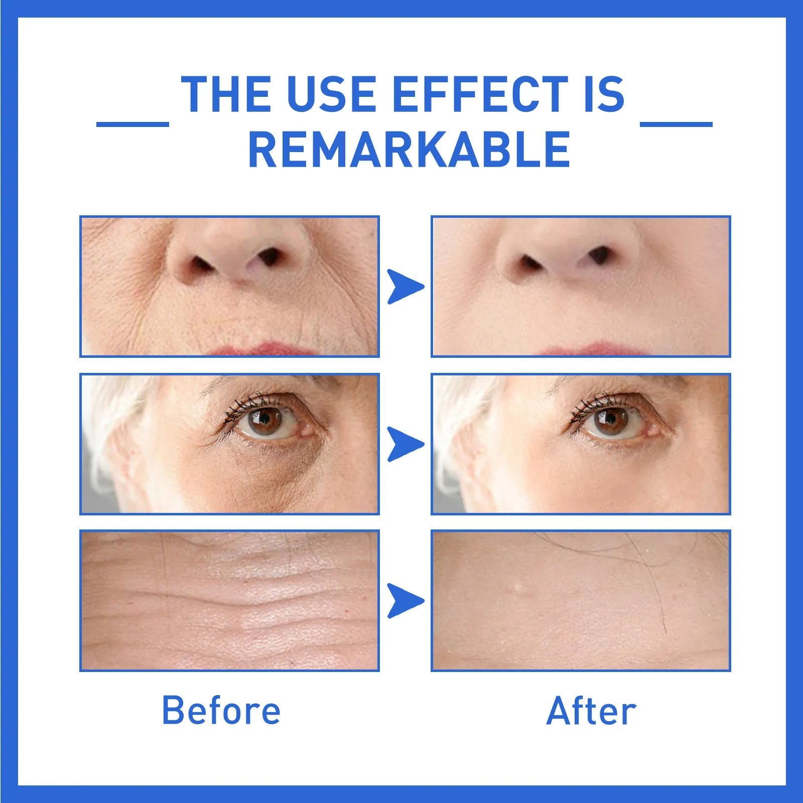 Anti aging WEST& MONTH