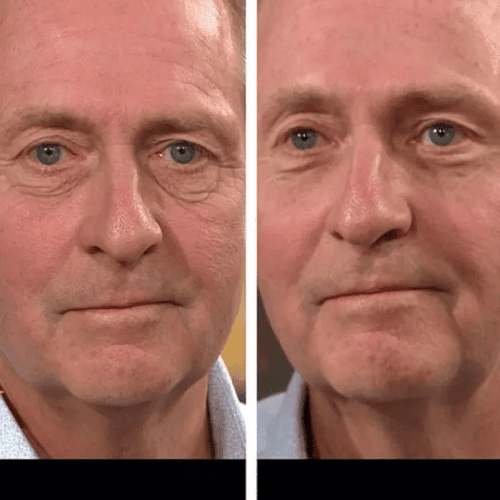 Firming Eye - myglowmuse