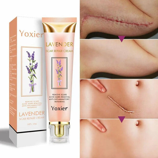 Healing Cream YOXIER - myglowmuse